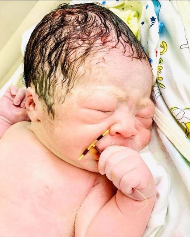 Baby Born Holding Mum’s Contraceptive Supposed To Stop Her From Getting Pregnant (Photos)